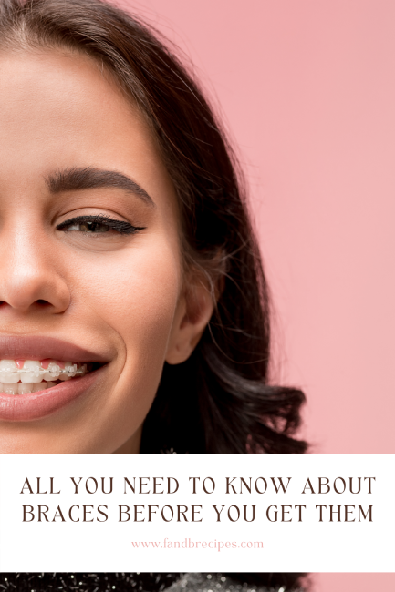 All You Need To Know About Braces Before You Get Them Pin