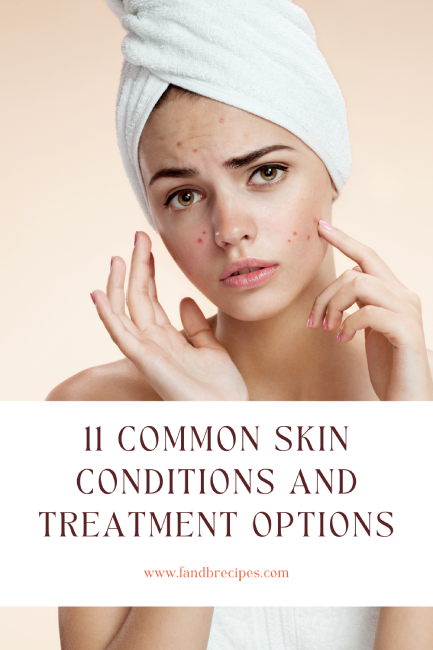 11 Common Skin Conditions and Treatment Options Pin